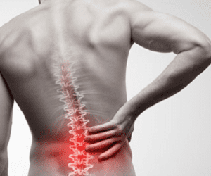 10 COMMON MYTHS ON LOW BACK PAIN