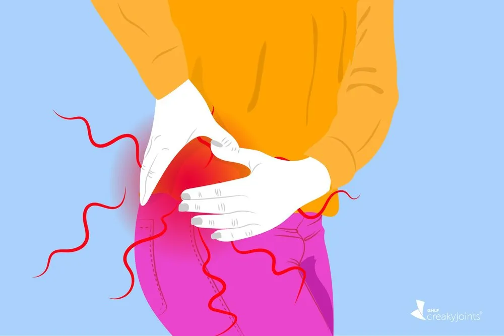 Physical Therapy for Hip Osteoarthritis