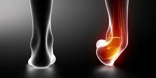 Ankle Sprain Recovery Game