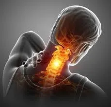 Neck Strengthening for Neck Pain